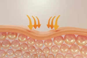skin layer skin layer